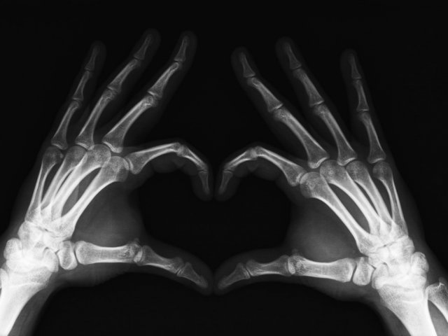 X_Ray_Heart_by_mmattes